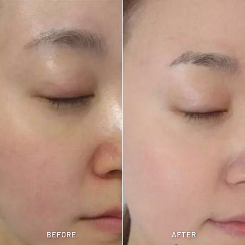 Skin Brightening Combo