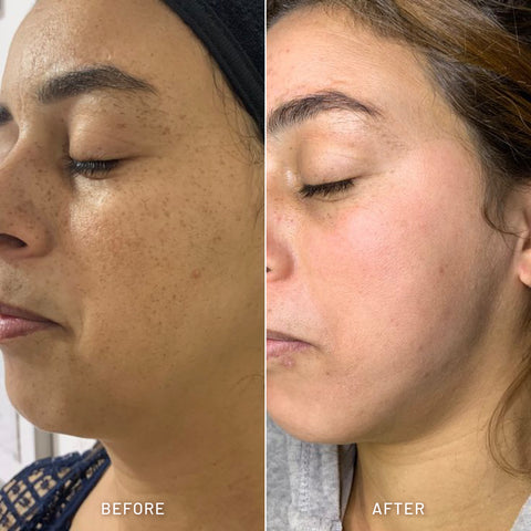 Skin Brightening Combo