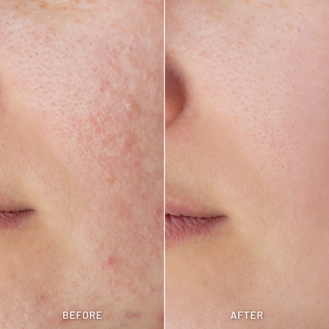 Skin Hydrating Combo