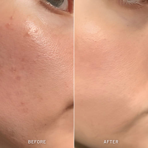 Oil Balancing Facial Cleanser