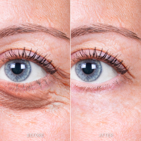 Advanced 7X Eye Serum