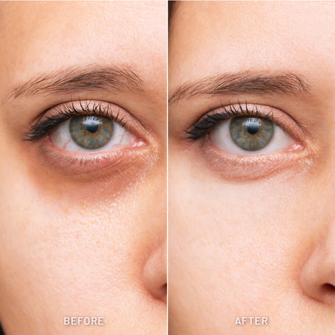 Advanced 7X Eye Serum