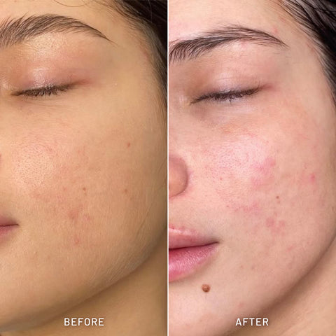 Fragrance Free Facial Cleanser