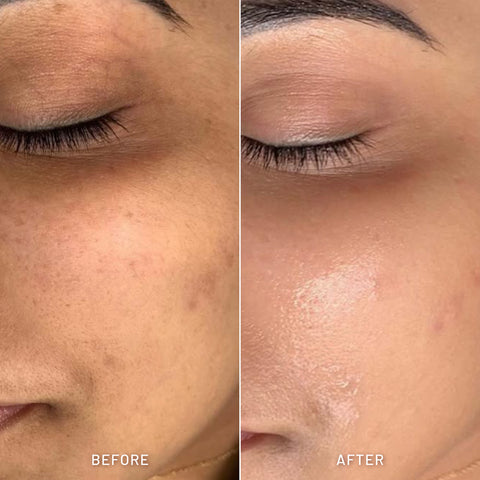 Ultra Soothing Hydrating Gel