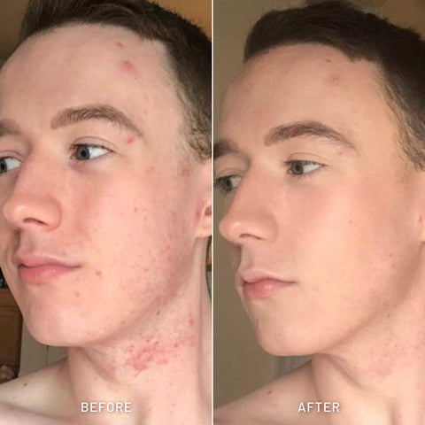 Men Detox Facial Wash