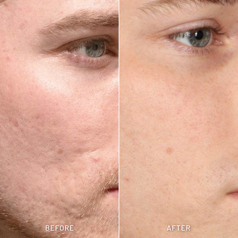 Men Detox Facial Wash