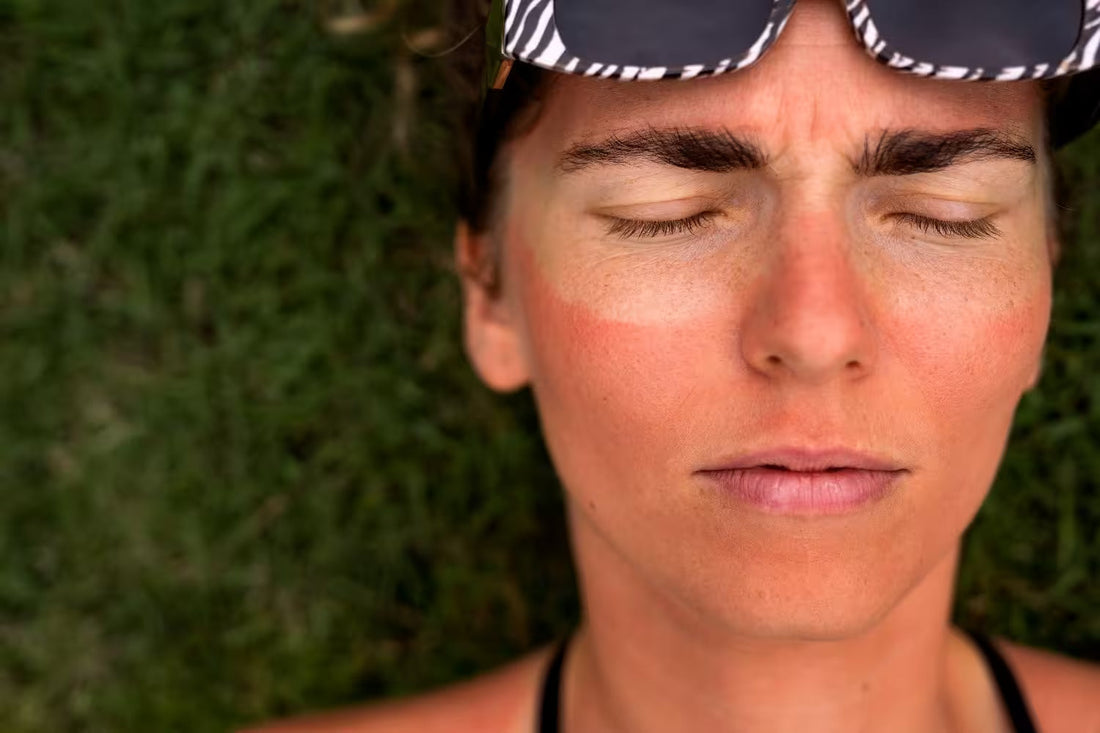Sweat, SPF and Breakouts: A Minimal Natural Skincare Routine That Survives Summer Humidity